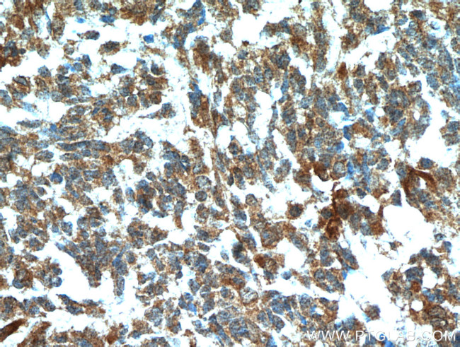 FABP7 Antibody in Immunohistochemistry (Paraffin) (IHC (P))