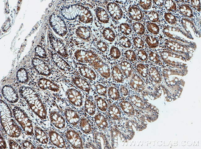 SPTLC2 Antibody in Immunohistochemistry (Paraffin) (IHC (P))