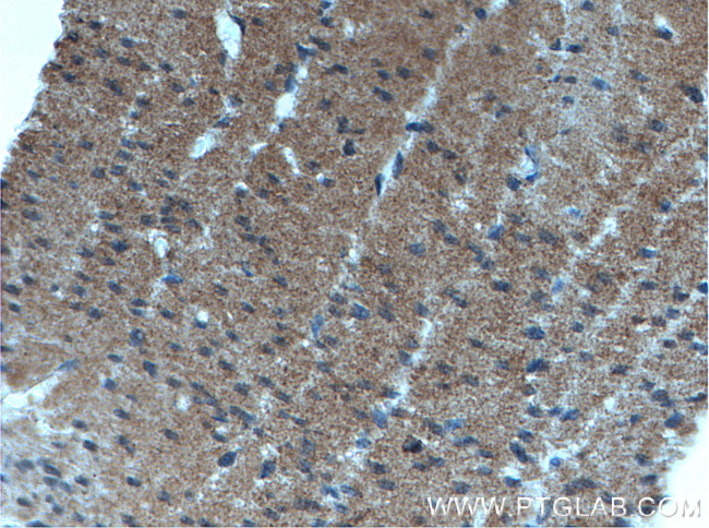 SPTLC2 Antibody in Immunohistochemistry (Paraffin) (IHC (P))