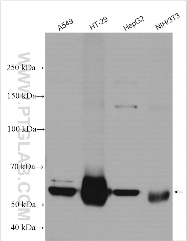 SPTLC2 Antibody in Western Blot (WB)