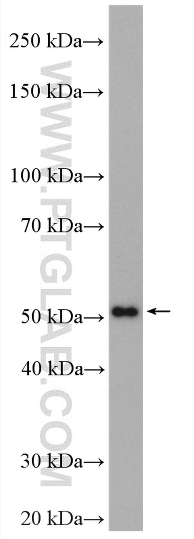 SPTLC2 Antibody in Western Blot (WB)