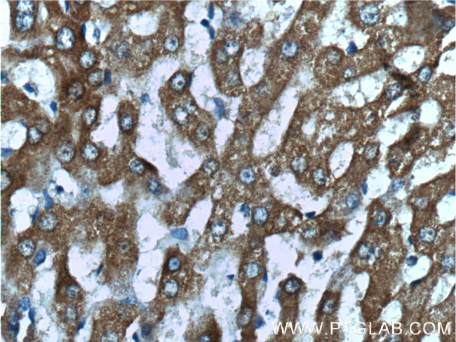 GRHPR Antibody in Immunohistochemistry (Paraffin) (IHC (P))