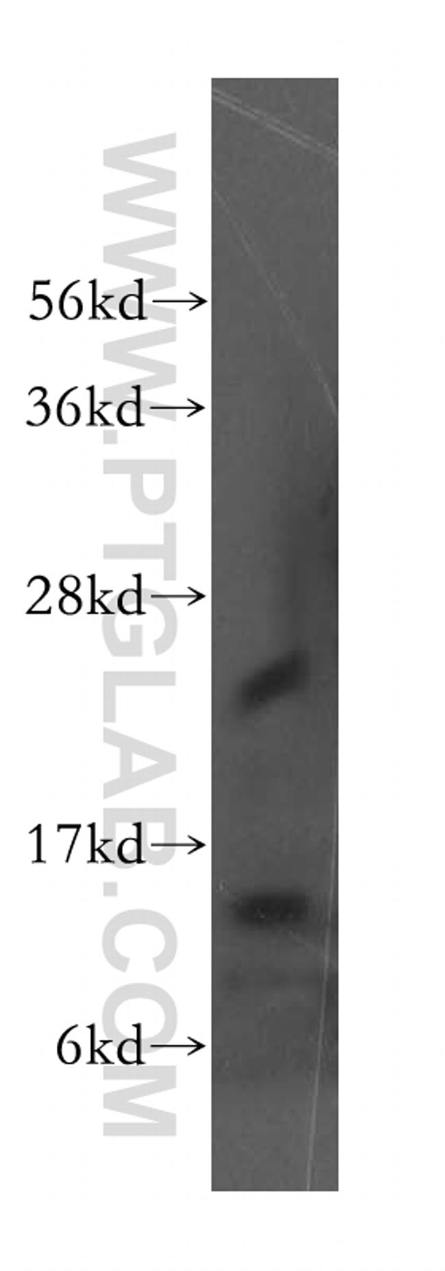 Evi2a Antibody in Western Blot (WB)