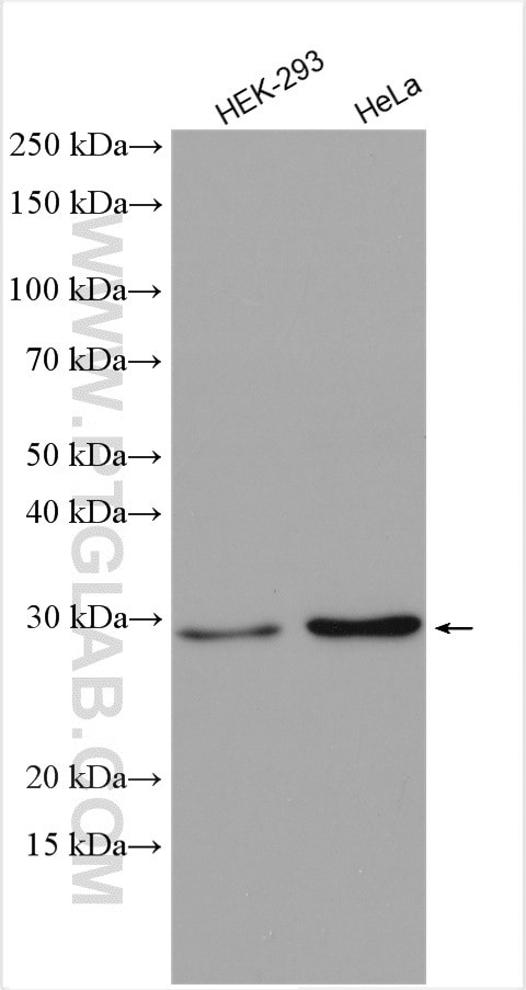 ACOT7L Antibody in Western Blot (WB)