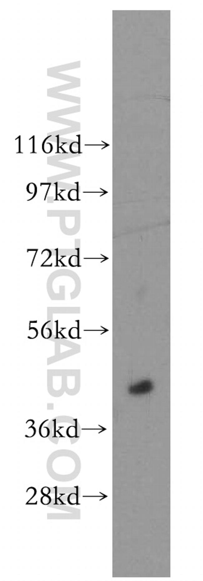 ACOT7L Antibody in Western Blot (WB)