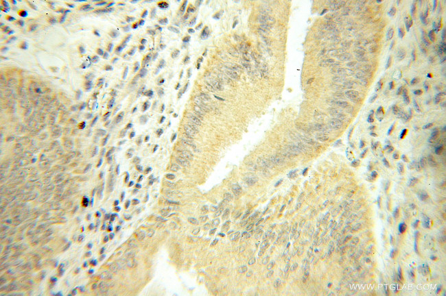 Mecr Antibody in Immunohistochemistry (Paraffin) (IHC (P))