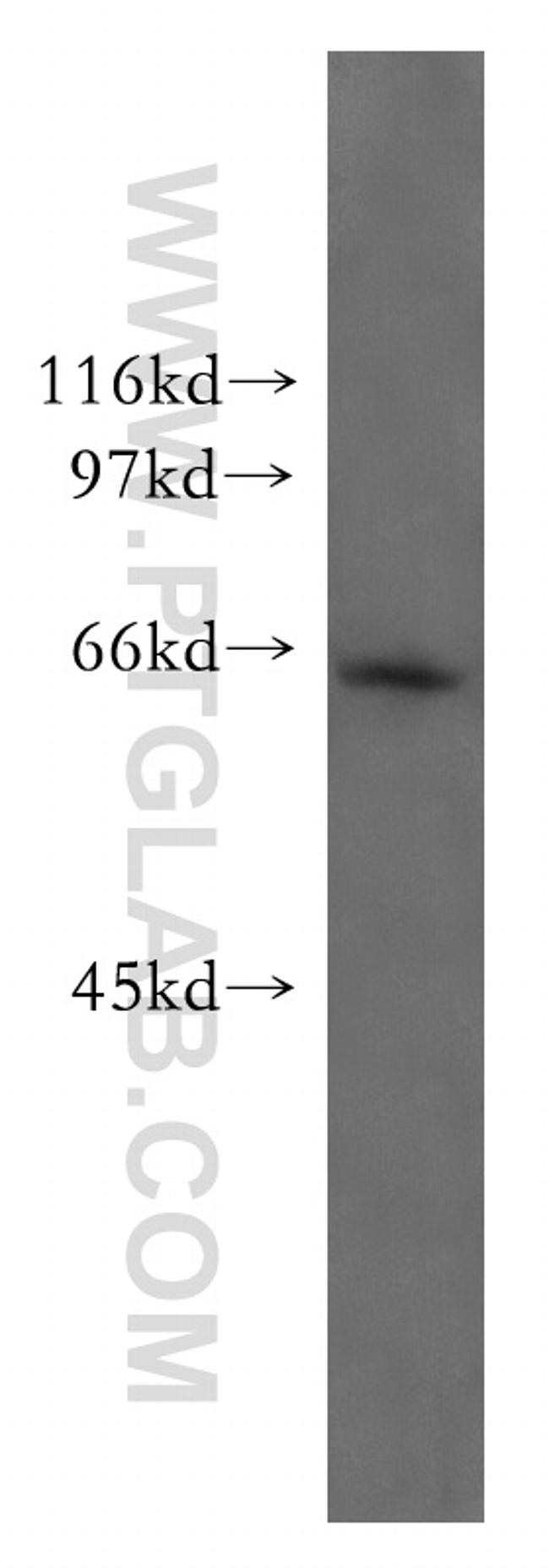 Mecr Antibody in Western Blot (WB)