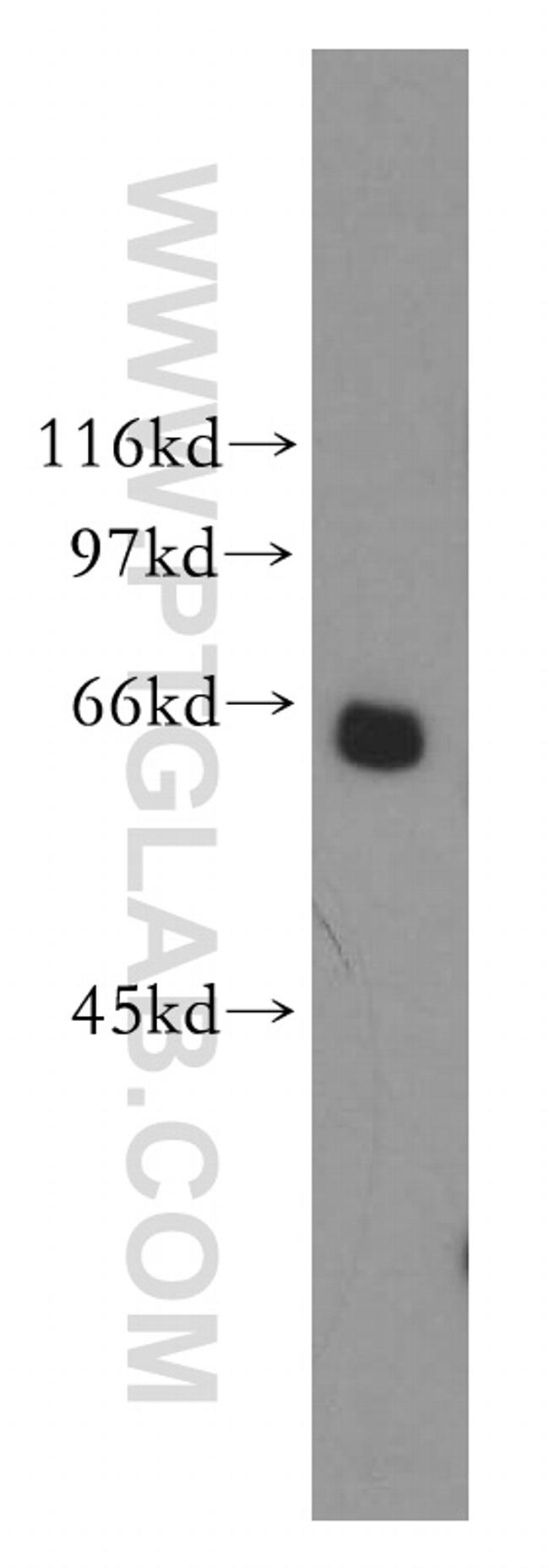 Mecr Antibody in Western Blot (WB)