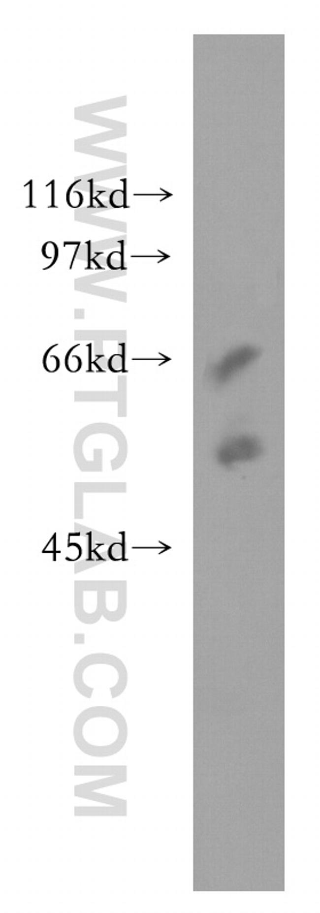 SSTR5 Antibody in Western Blot (WB)