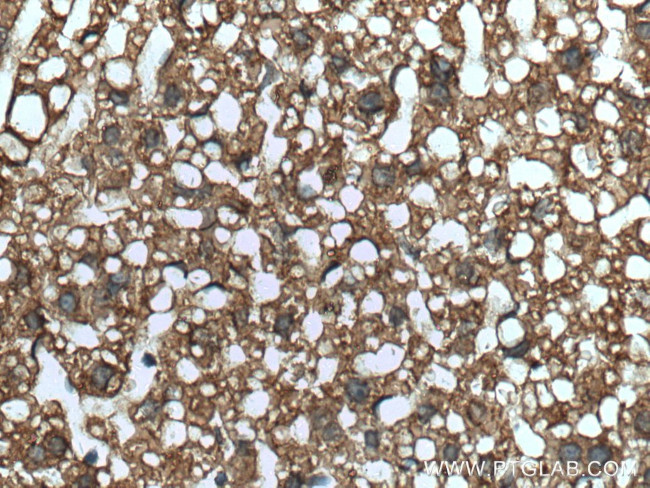 SLC25A6 Antibody in Immunohistochemistry (Paraffin) (IHC (P))
