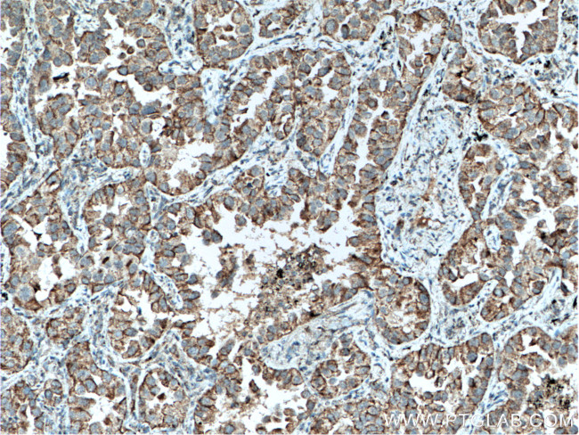 SLC25A6 Antibody in Immunohistochemistry (Paraffin) (IHC (P))