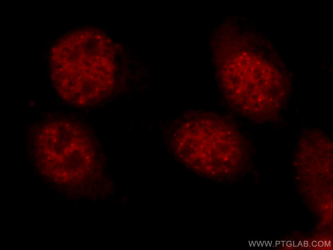 HSF1 Antibody in Immunocytochemistry (ICC/IF)