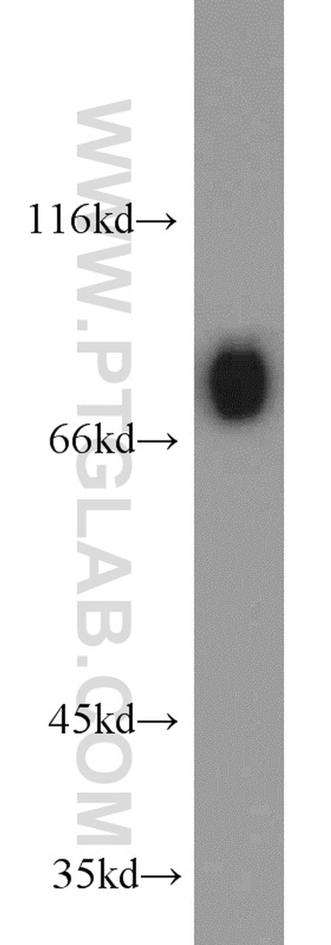 HSF1 Antibody in Western Blot (WB)