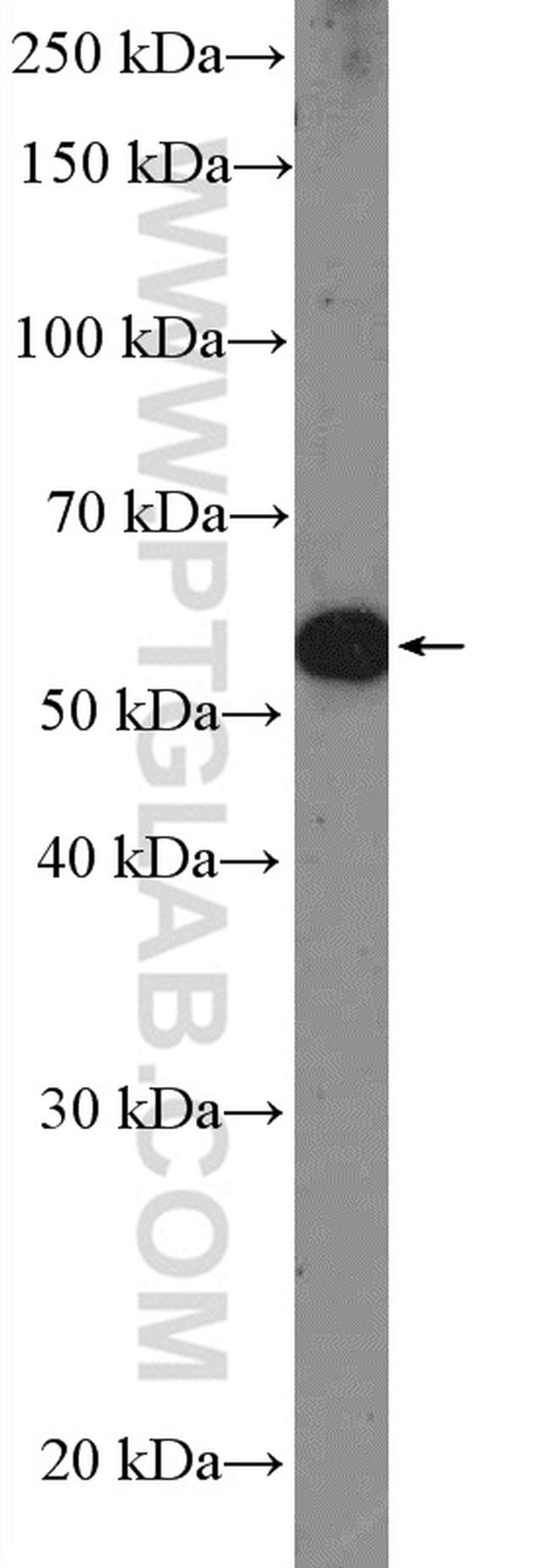 PAX3 Antibody in Western Blot (WB)