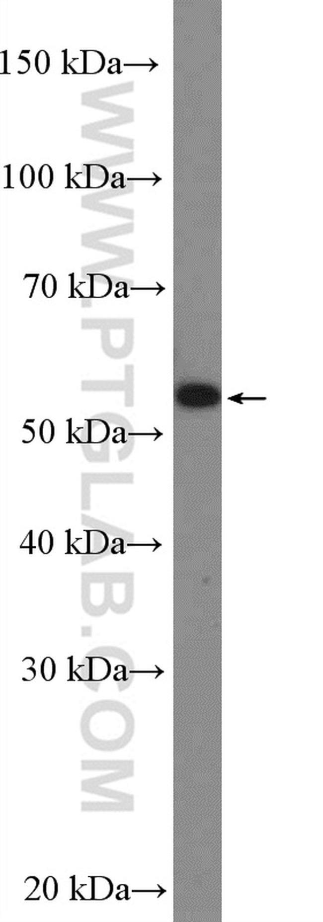 PAX3 Antibody in Western Blot (WB)