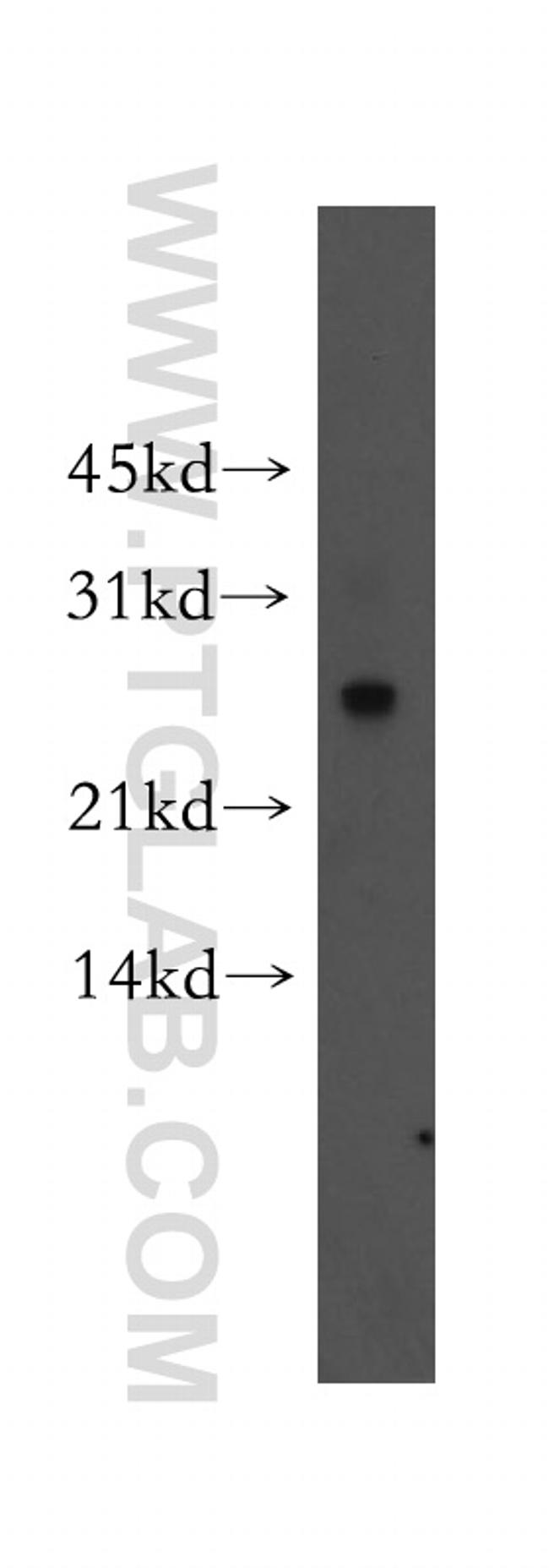 Connexin-26 Antibody in Western Blot (WB)