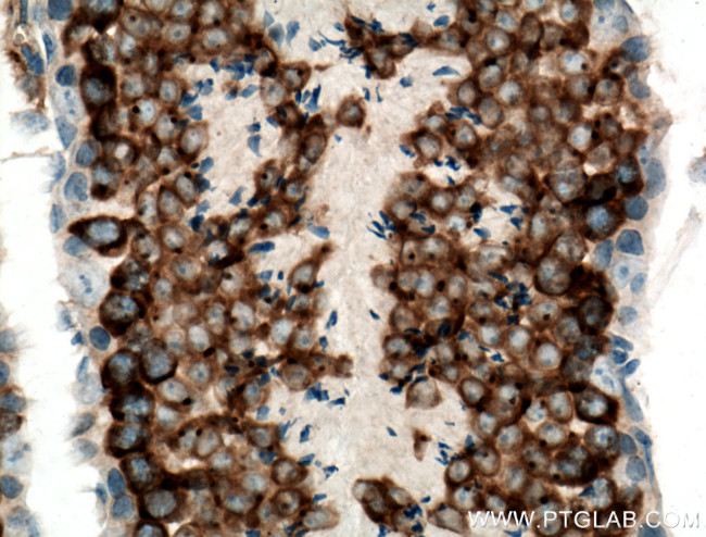 DDX4/VASA Antibody in Immunohistochemistry (Paraffin) (IHC (P))