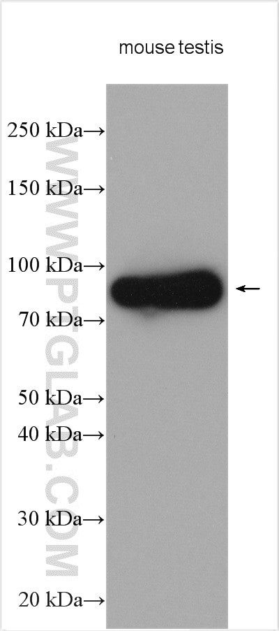 DDX4/VASA Antibody in Western Blot (WB)