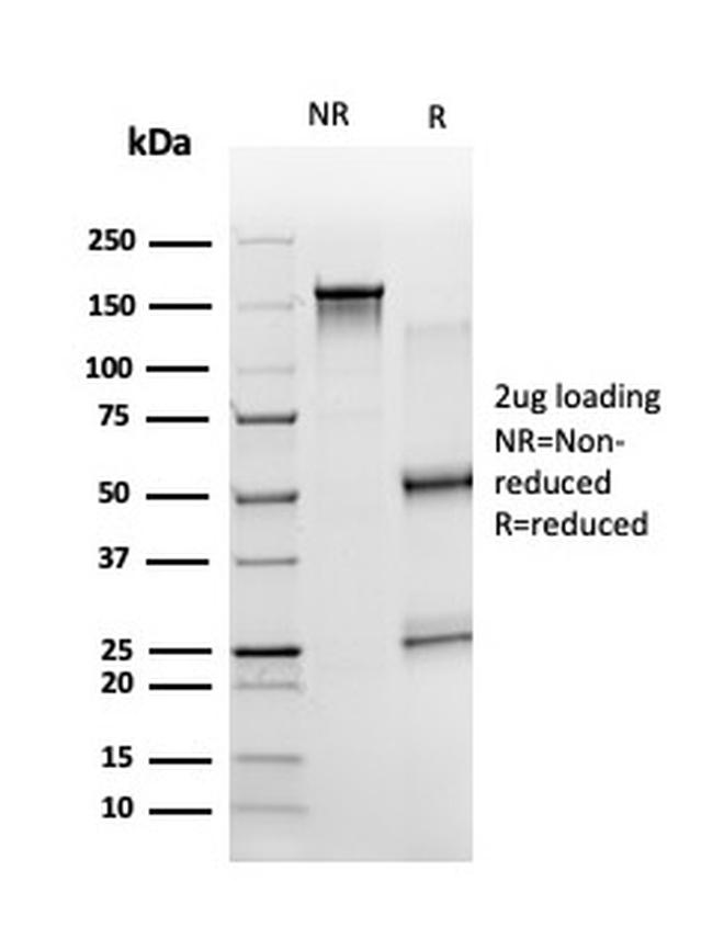 ZBTB7B Antibody in SDS-PAGE (SDS-PAGE)