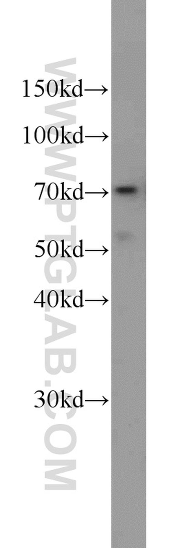 ELL Antibody in Western Blot (WB)