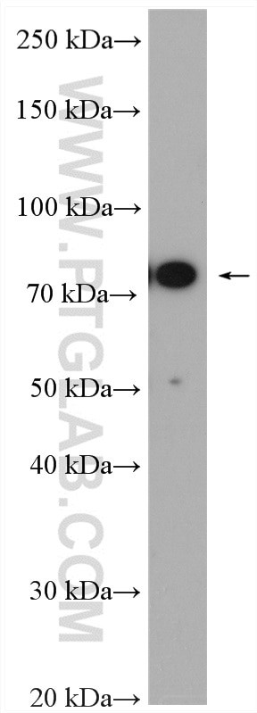 Cd2ap Antibody in Western Blot (WB)