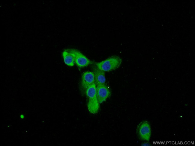 Cd2ap Antibody in Immunocytochemistry (ICC/IF)