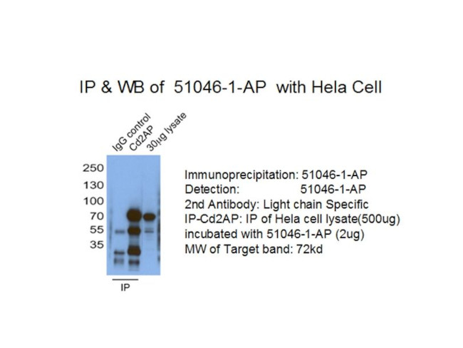 Cd2ap Antibody in Immunoprecipitation (IP)
