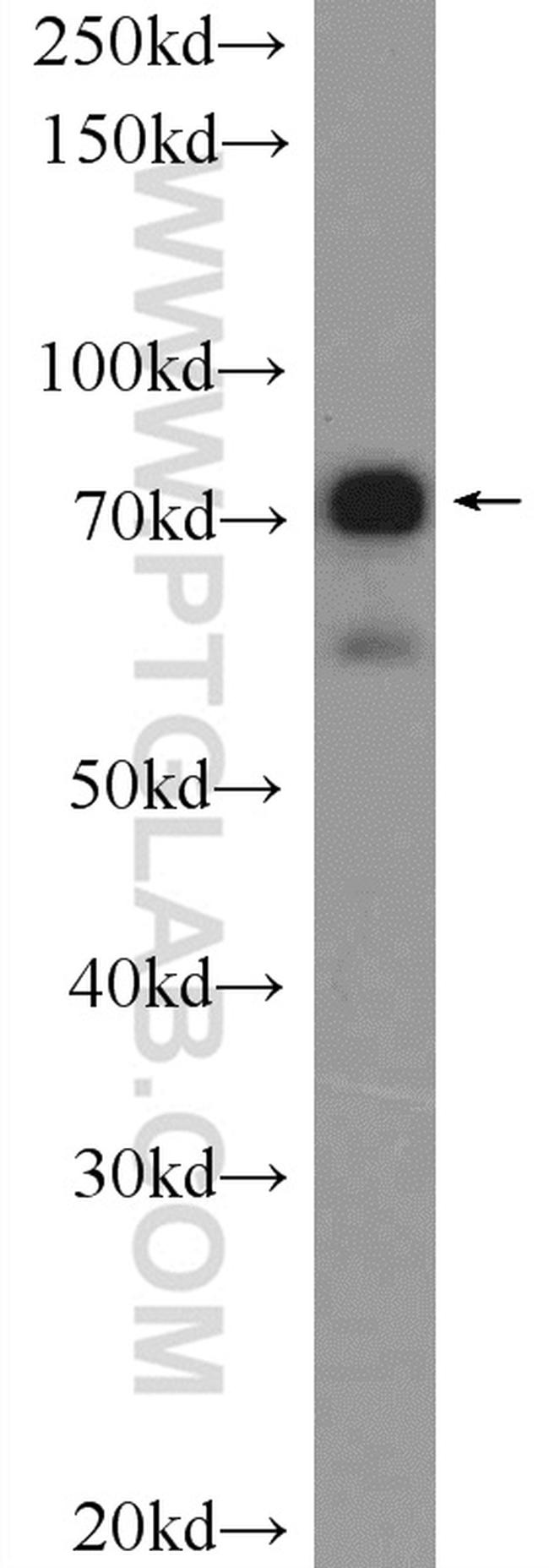 Cd2ap Antibody in Western Blot (WB)