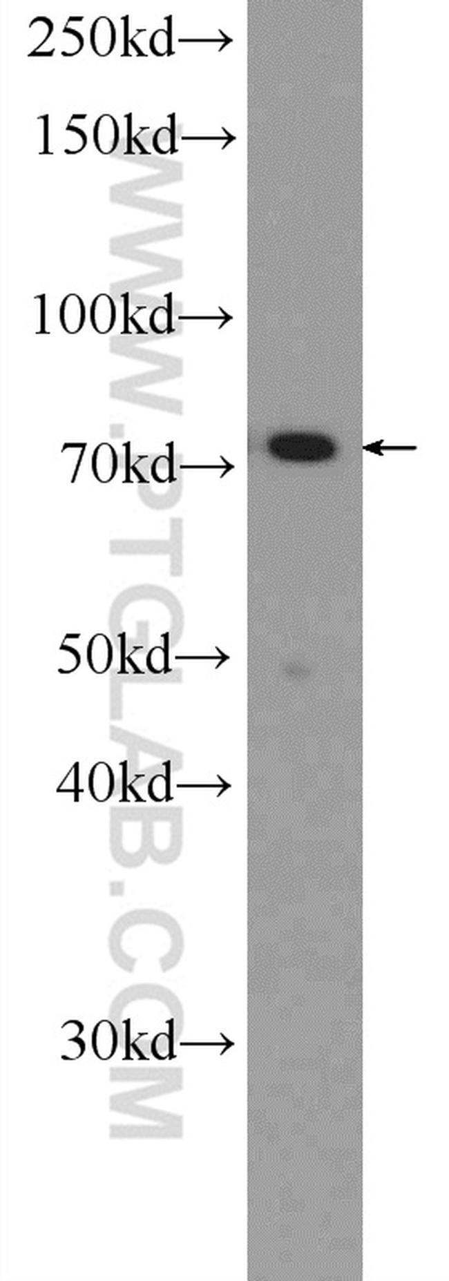 Cd2ap Antibody in Western Blot (WB)