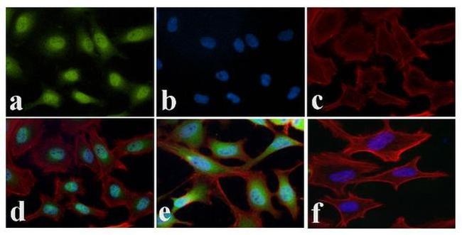 NFkB p65 Antibody