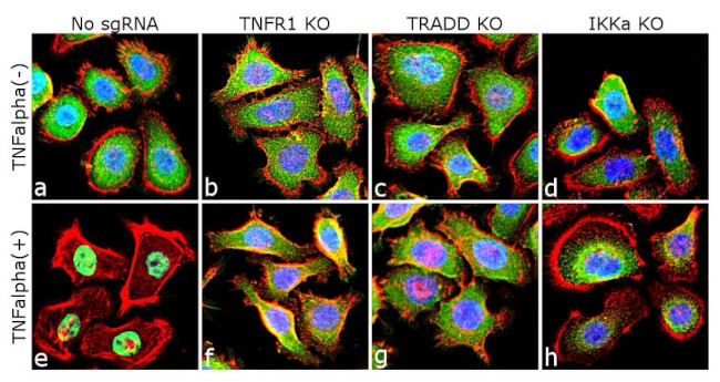 NFkB p65 Antibody