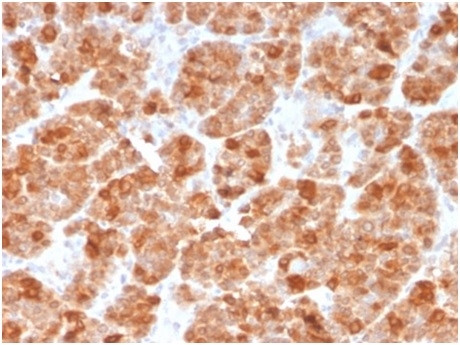 Geminin/DNA Replication Inhibitor Antibody in Immunohistochemistry (Paraffin) (IHC (P))