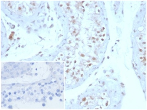 Geminin/DNA Replication Inhibitor Antibody in Immunohistochemistry (Paraffin) (IHC (P))