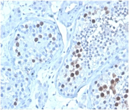 Geminin/DNA Replication Inhibitor Antibody in Immunohistochemistry (Paraffin) (IHC (P))