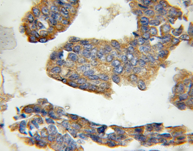 CRLS1 Antibody in Immunohistochemistry (Paraffin) (IHC (P))