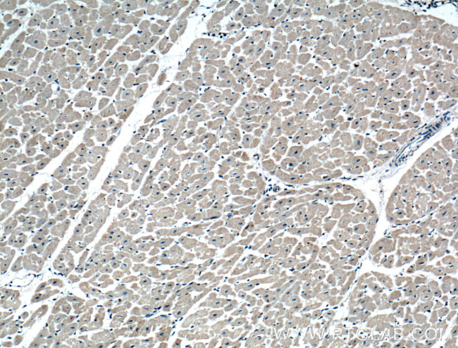 CRLS1 Antibody in Immunohistochemistry (Paraffin) (IHC (P))