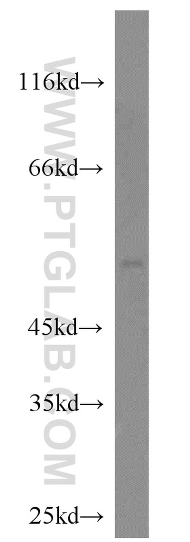 CRLS1 Antibody in Western Blot (WB)