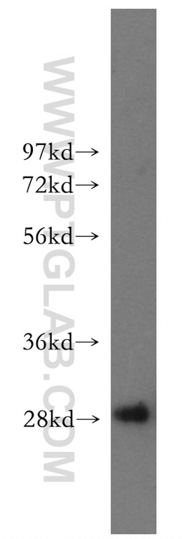 Hepsin Antibody in Western Blot (WB)