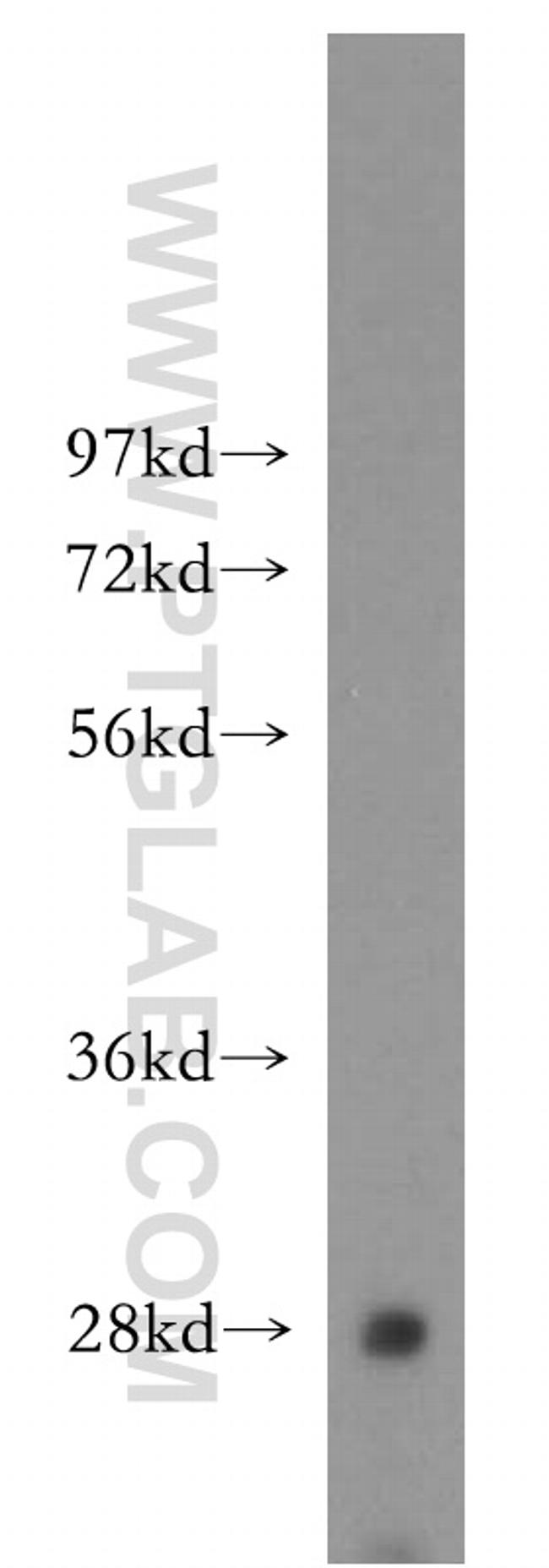 Hepsin Antibody in Western Blot (WB)