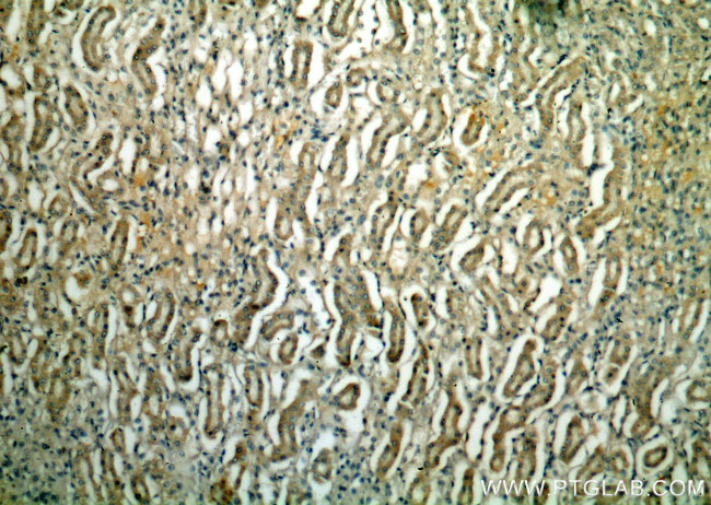 PLSCR3 Antibody in Immunohistochemistry (Paraffin) (IHC (P))