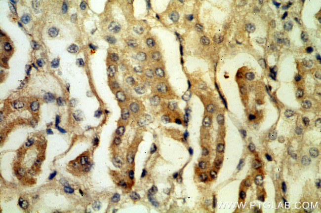 PLSCR3 Antibody in Immunohistochemistry (Paraffin) (IHC (P))