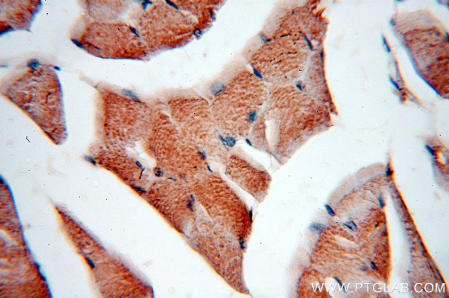 PLSCR3 Antibody in Immunohistochemistry (Paraffin) (IHC (P))