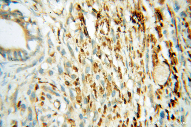 GSK3B Antibody in Immunohistochemistry (Paraffin) (IHC (P))