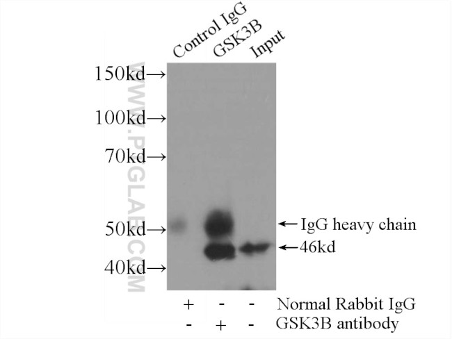 GSK3B Antibody in Immunoprecipitation (IP)