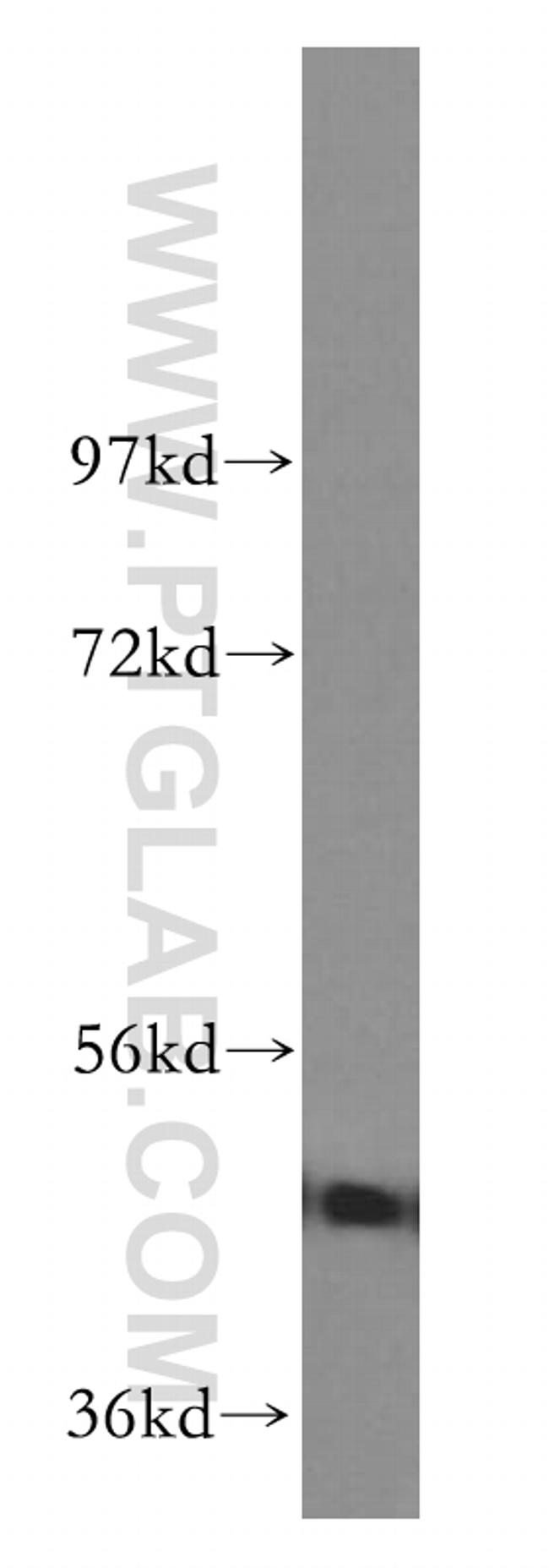 GSK3B Antibody in Western Blot (WB)