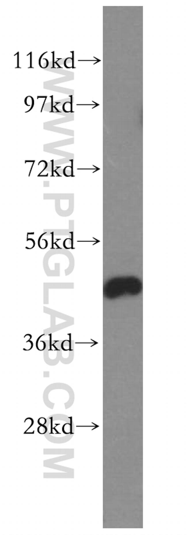 GSK3B Antibody in Western Blot (WB)