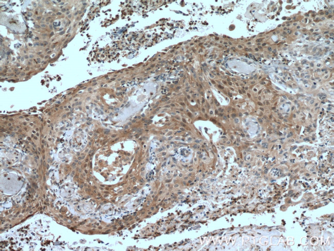 IkB alpha Antibody in Immunohistochemistry (Paraffin) (IHC (P))