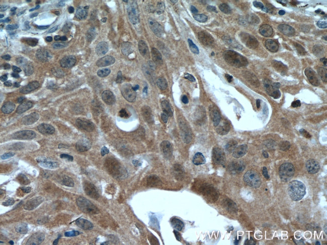 IkB alpha Antibody in Immunohistochemistry (Paraffin) (IHC (P))