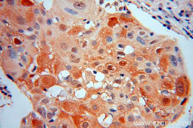 IkB alpha Antibody in Immunohistochemistry (Paraffin) (IHC (P))