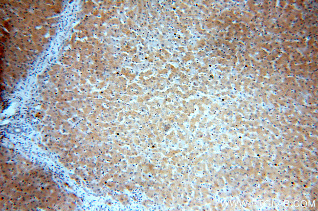 IkB alpha Antibody in Immunohistochemistry (Paraffin) (IHC (P))